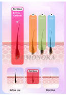 IPL Laser Hair Removal Device – Professional Home Epilator