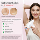 IPL Laser Hair Removal Device – Professional Home Epilator