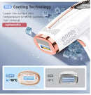 IPL Laser Hair Removal Device – Professional Home Epilator